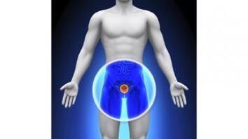 Prostatite chez un homme