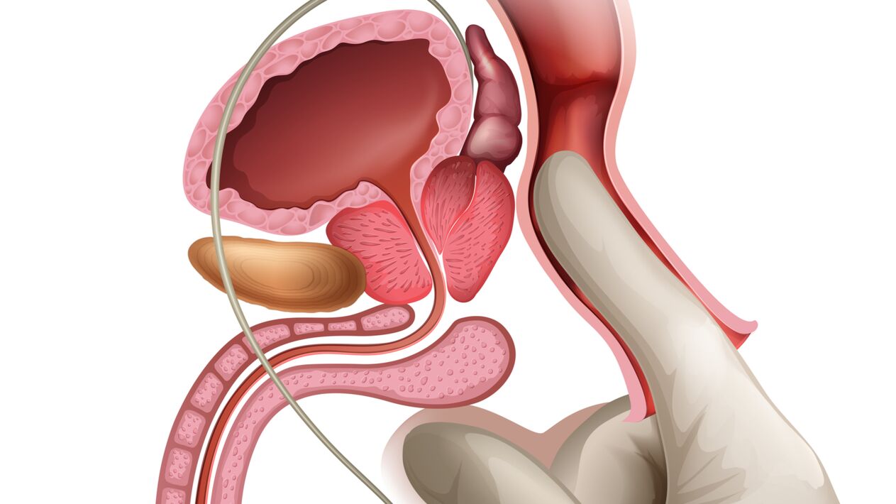 Le massage de la prostate est une méthode efficace pour traiter la prostatite congestive