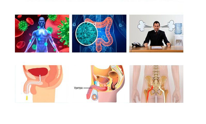 Causes de la prostatite